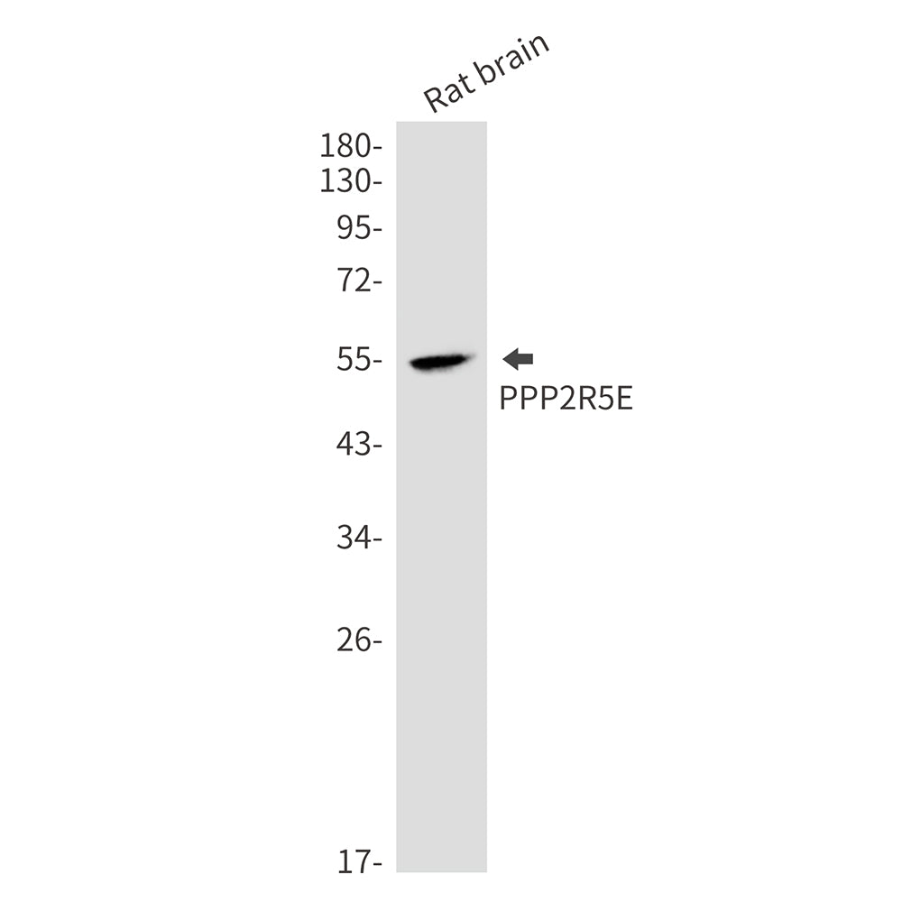 Anti-PPP2R5E Rabbit Monoclonal Antibody
