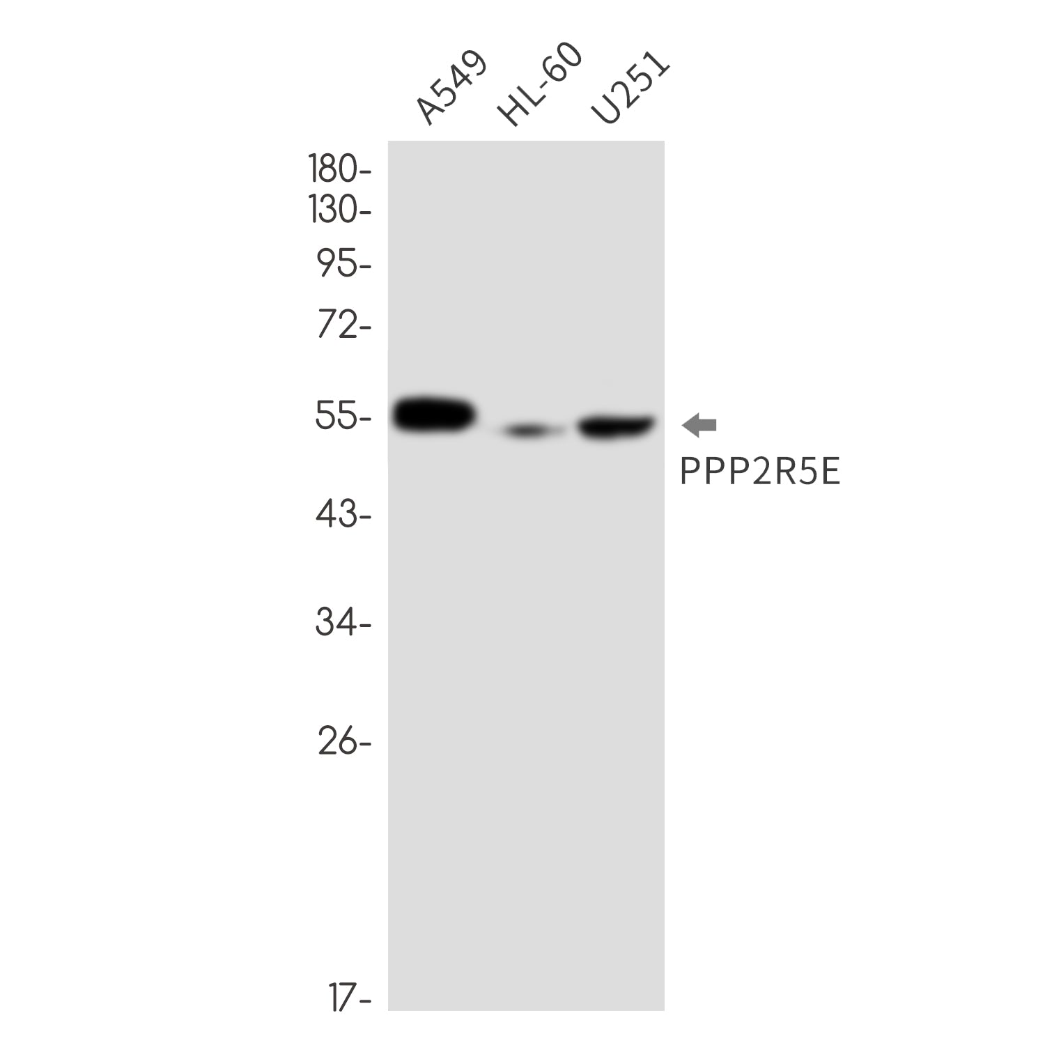 Anti-PPP2R5E Rabbit Monoclonal Antibody