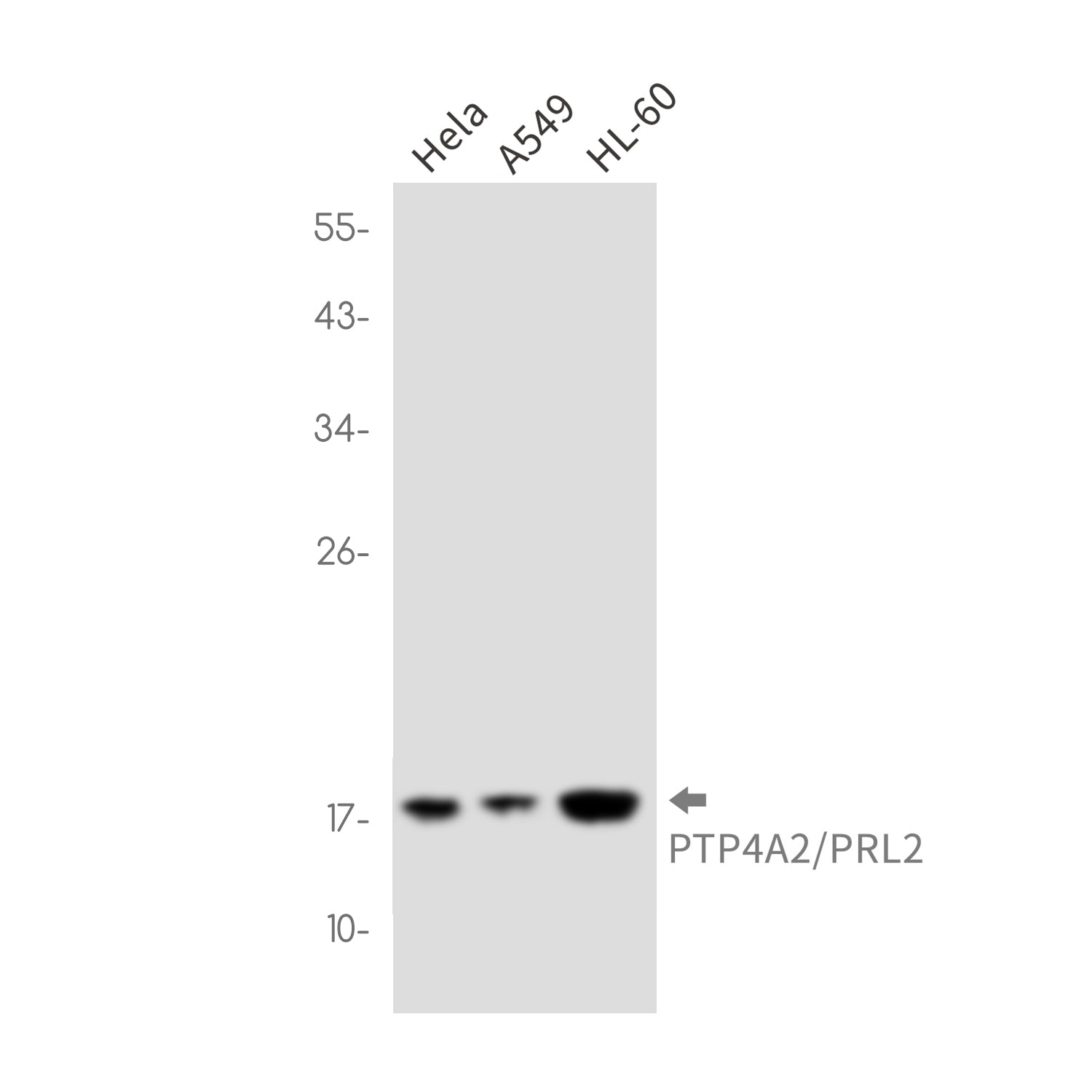 Anti-PTP4A2 Rabbit Monoclonal Antibody