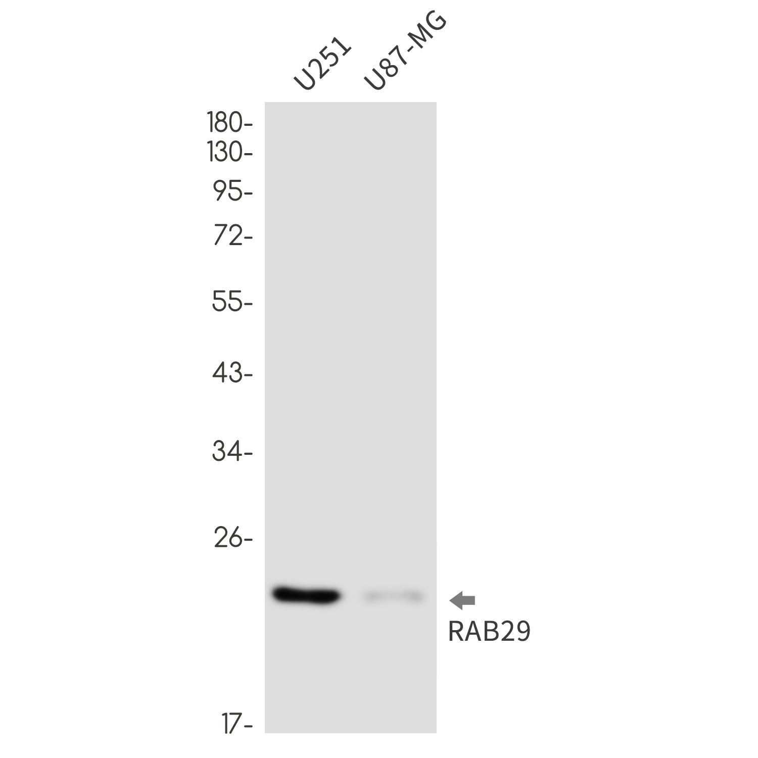 Anti-Rab29 Rabbit Monoclonal Antibody