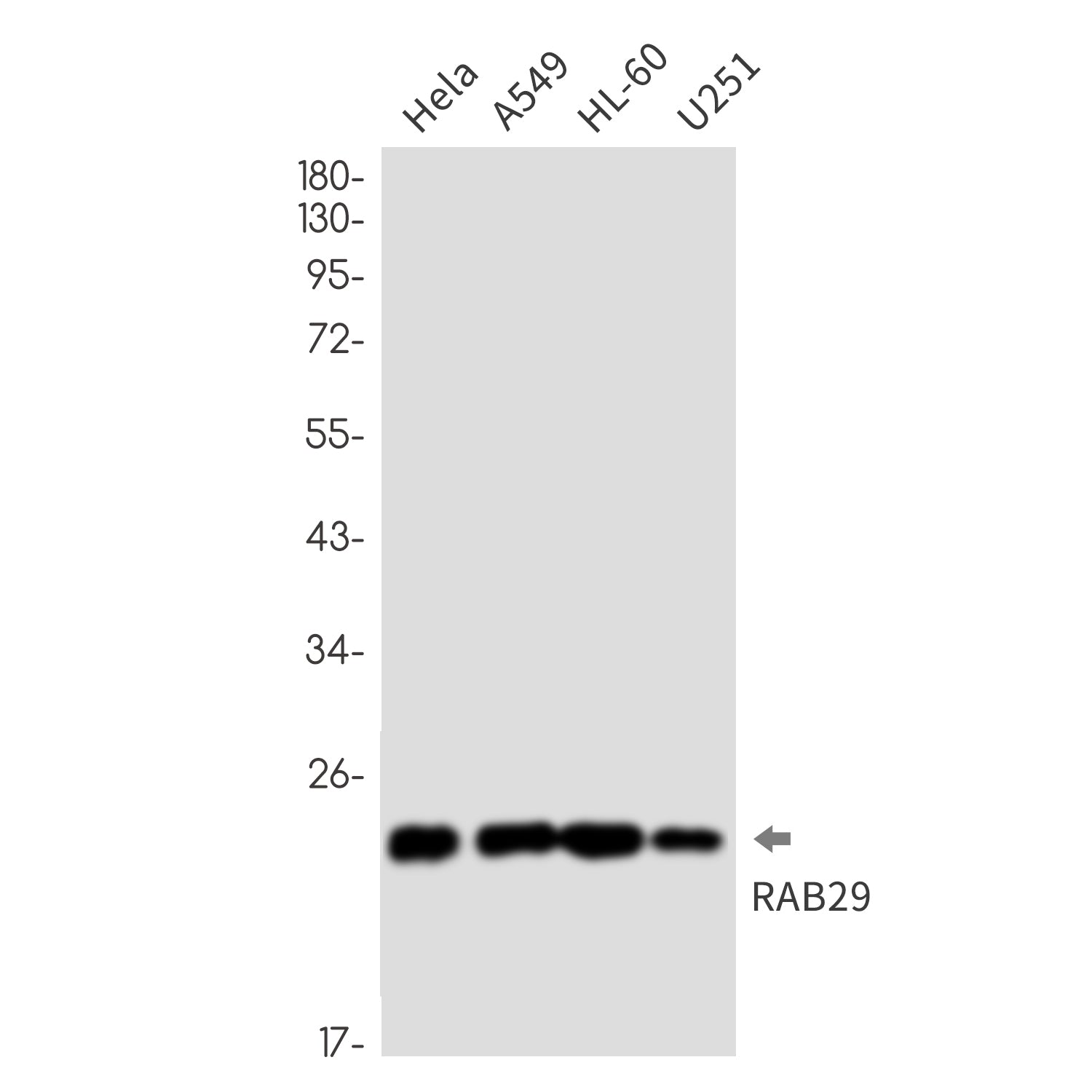 Anti-Rab29 Rabbit Monoclonal Antibody