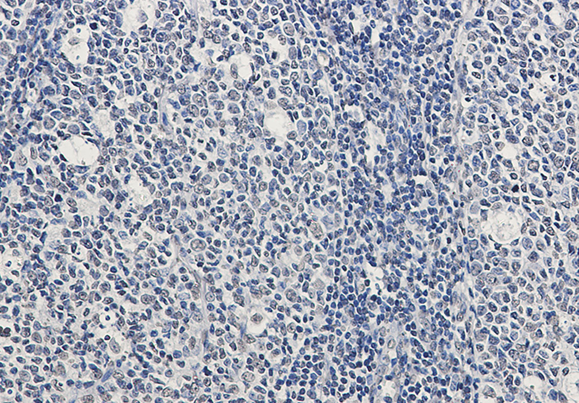 Anti-Rad51 Rabbit Monoclonal Antibody