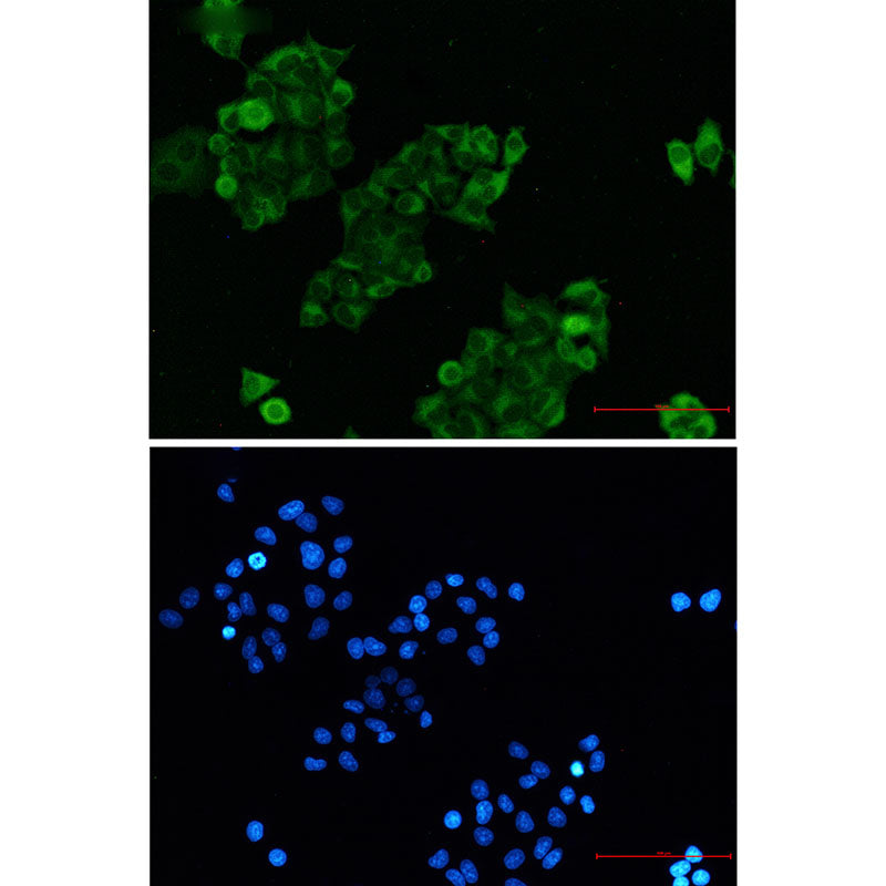 Anti-RAIDD Rabbit Monoclonal Antibody