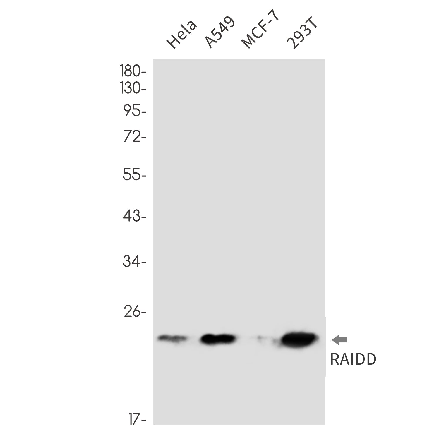 Anti-RAIDD Rabbit Monoclonal Antibody