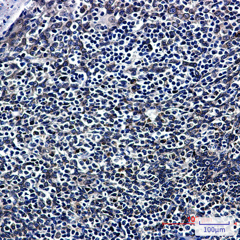 Anti-RanGAP1 Rabbit Monoclonal Antibody