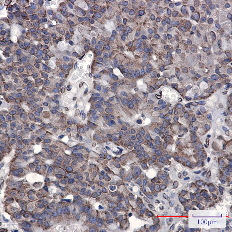 Anti-RAP80 Rabbit Monoclonal Antibody