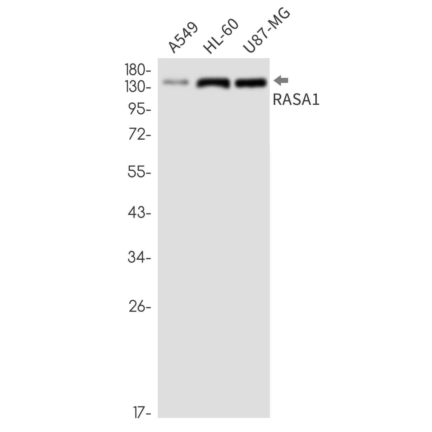 Anti-RASA1 Rabbit Monoclonal Antibody