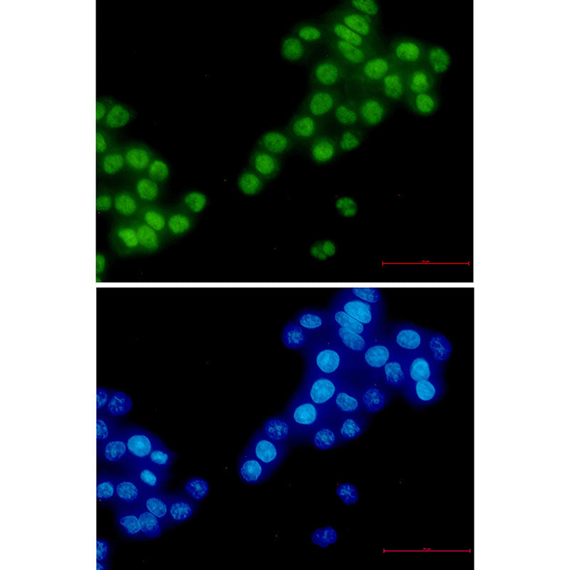 Anti-RBM3 Rabbit Monoclonal Antibody