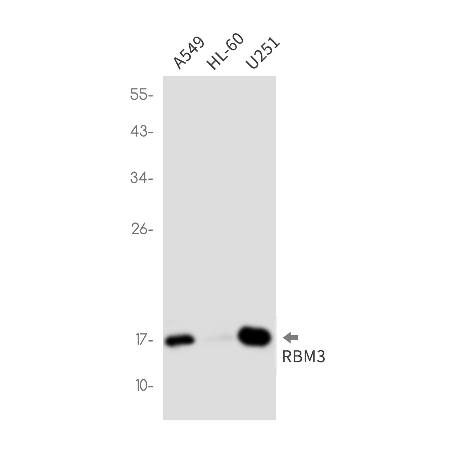 Anti-RBM3 Rabbit Monoclonal Antibody