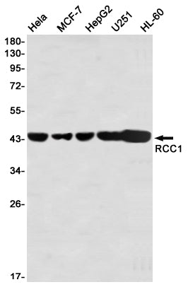 Anti-RCC1 Rabbit Monoclonal Antibody