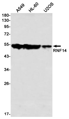 Anti-RNF14 Rabbit Monoclonal Antibody