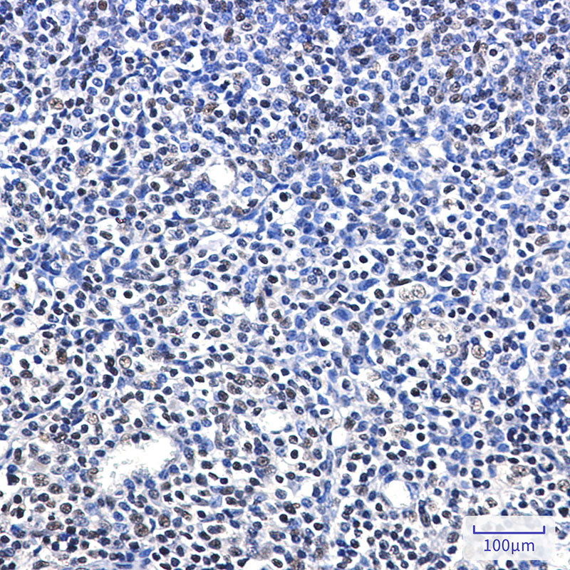 Anti-RPA32 Rabbit Monoclonal Antibody