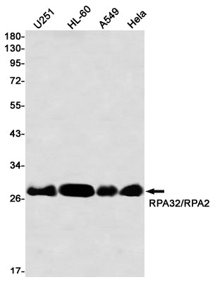Anti-RPA32 Rabbit Monoclonal Antibody