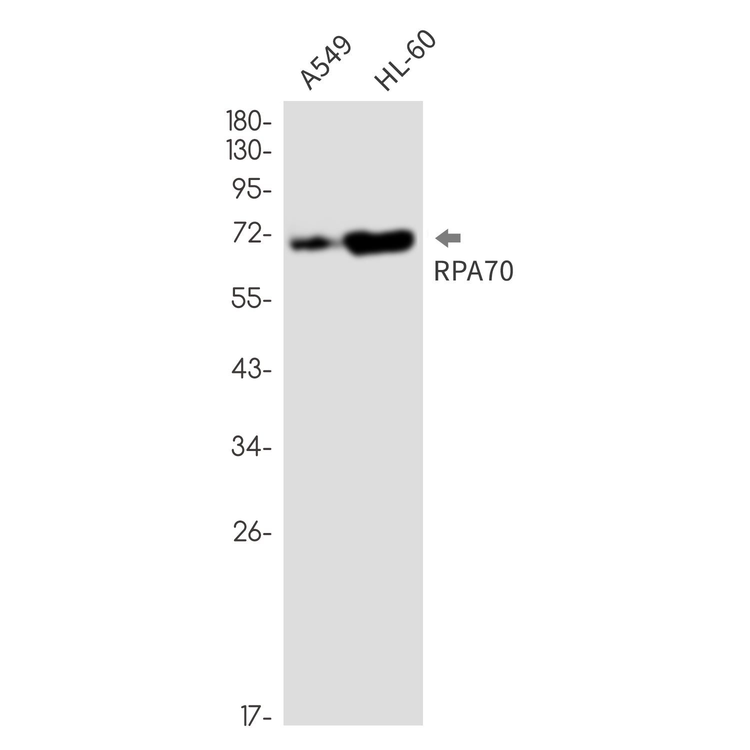 Anti-RPA70 Rabbit Monoclonal Antibody
