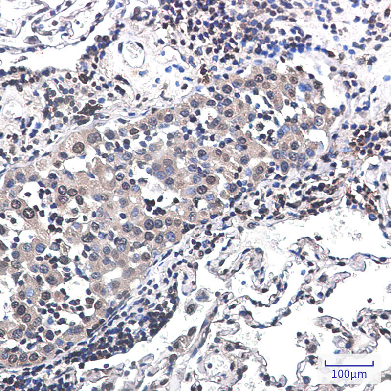 Anti-RSK2 Rabbit Monoclonal Antibody