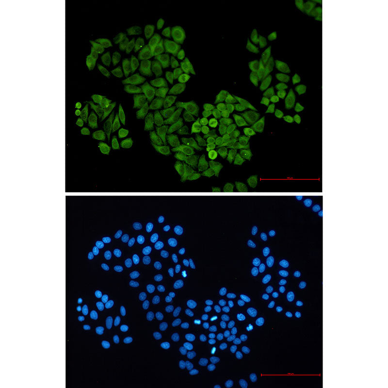 Anti-S100 alpha6 Rabbit Monoclonal Antibody
