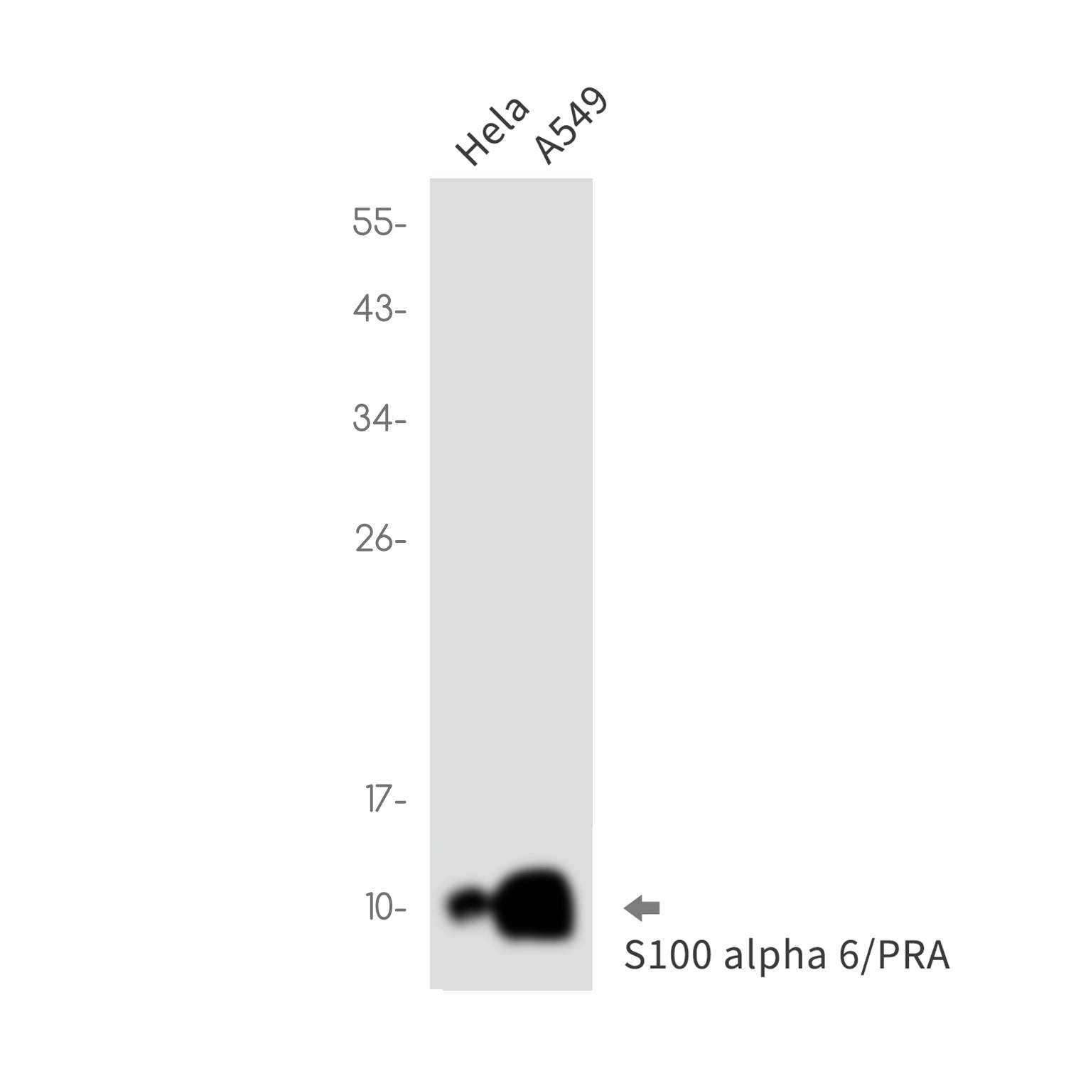 Anti-S100 alpha6 Rabbit Monoclonal Antibody