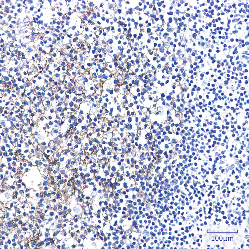 Anti-Semaphorin 7A Rabbit Monoclonal Antibody