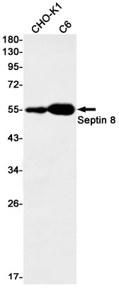 Anti-Septin 8 Rabbit Monoclonal Antibody