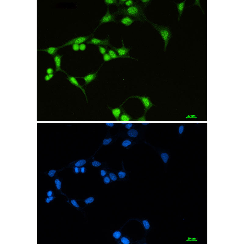 Anti-SF3B1 Rabbit Monoclonal Antibody