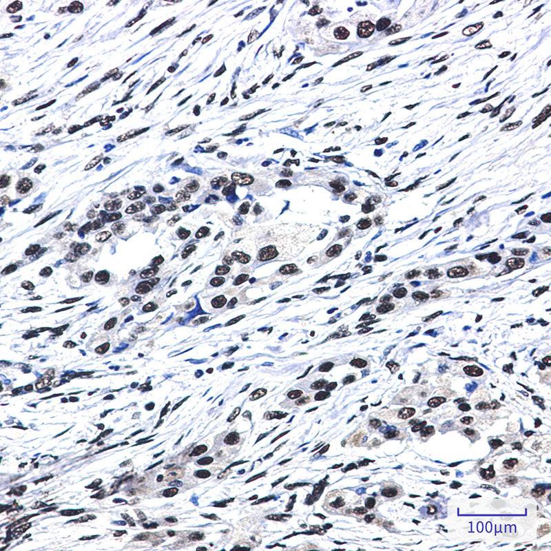 Anti-SF3B1 Rabbit Monoclonal Antibody