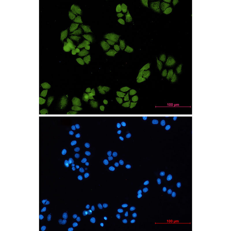 Anti-Smad4 Rabbit Monoclonal Antibody