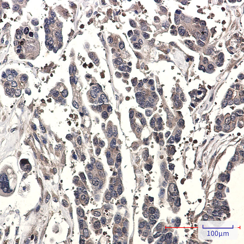 Anti-SPAK Rabbit Monoclonal Antibody