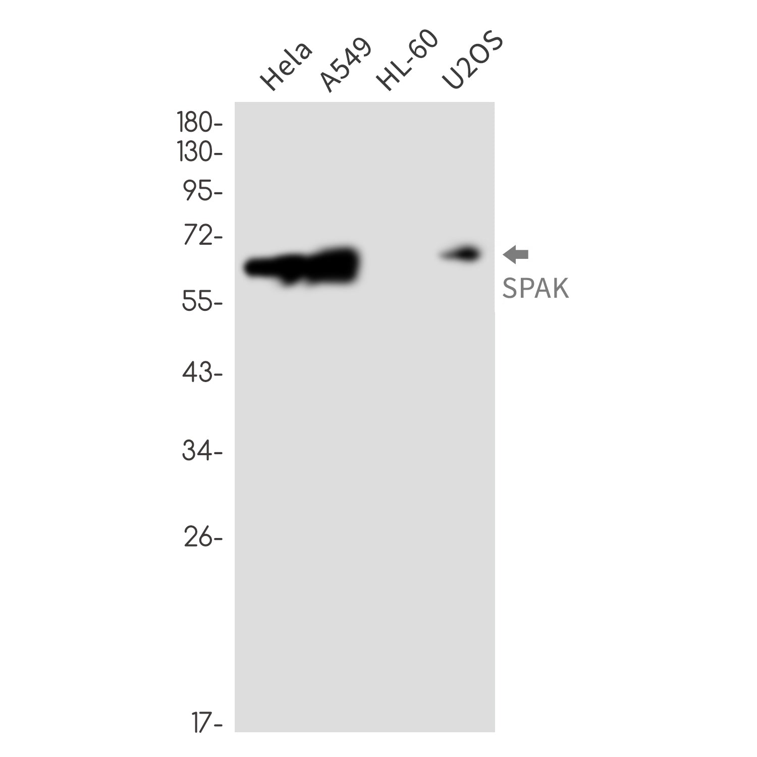 Anti-SPAK Rabbit Monoclonal Antibody