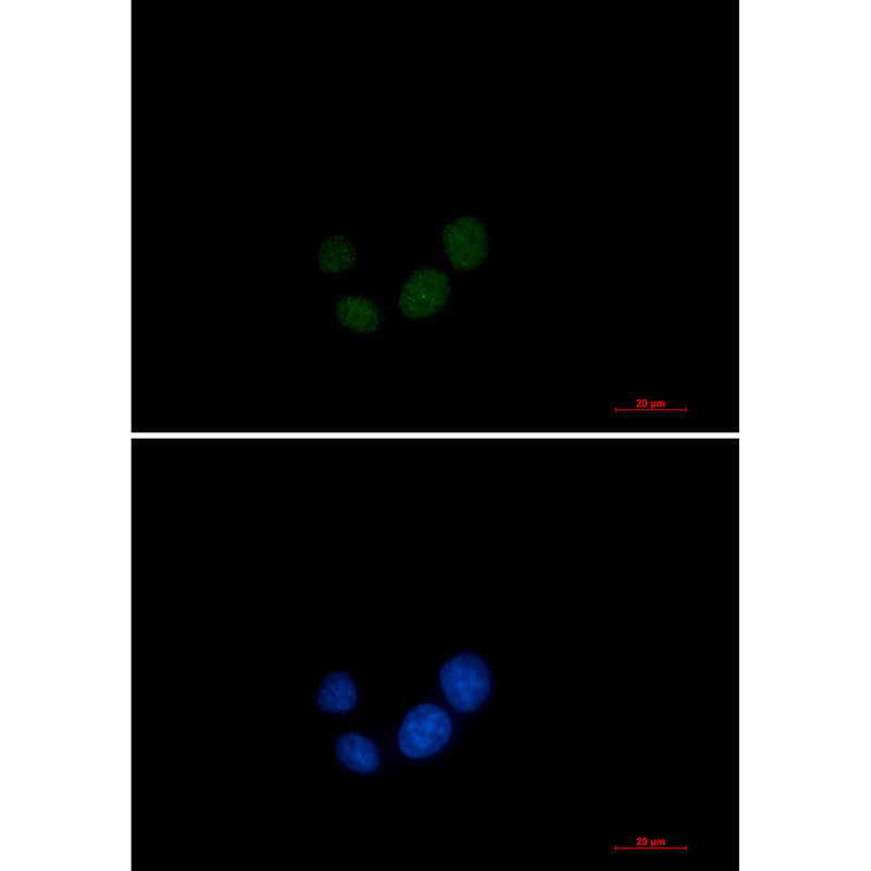 Anti-SPT5 Rabbit Monoclonal Antibody
