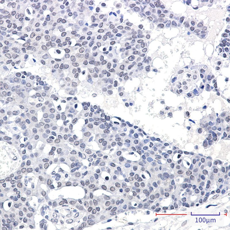 Anti-SPT5 Rabbit Monoclonal Antibody