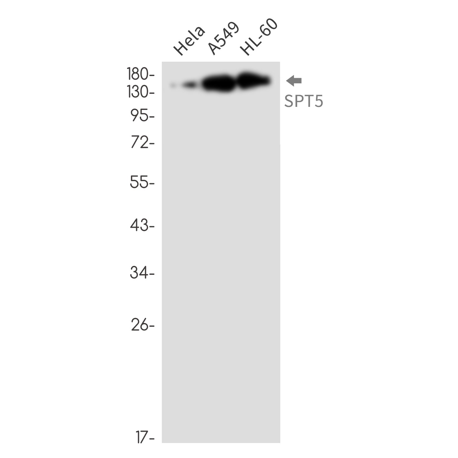 Anti-SPT5 Rabbit Monoclonal Antibody