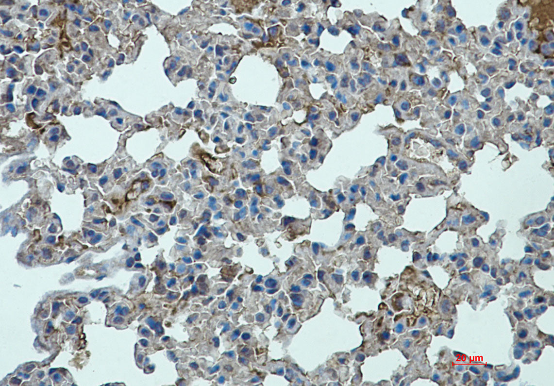 Anti-STAT2 Rabbit Monoclonal Antibody
