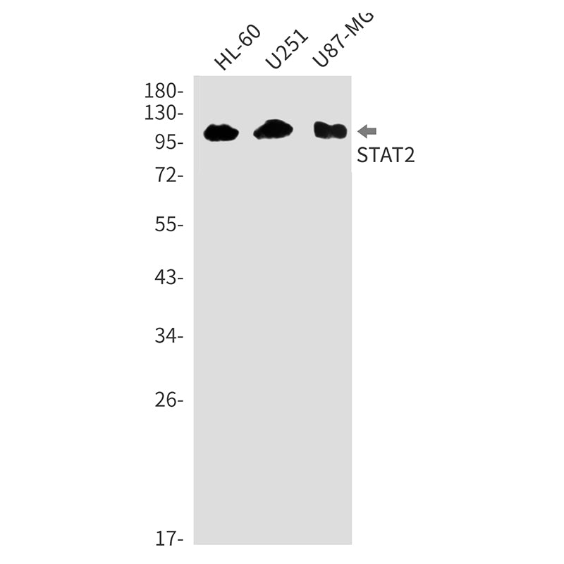 Anti-STAT2 Rabbit Monoclonal Antibody