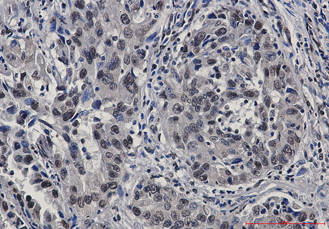 Anti-STAT4 Rabbit Monoclonal Antibody