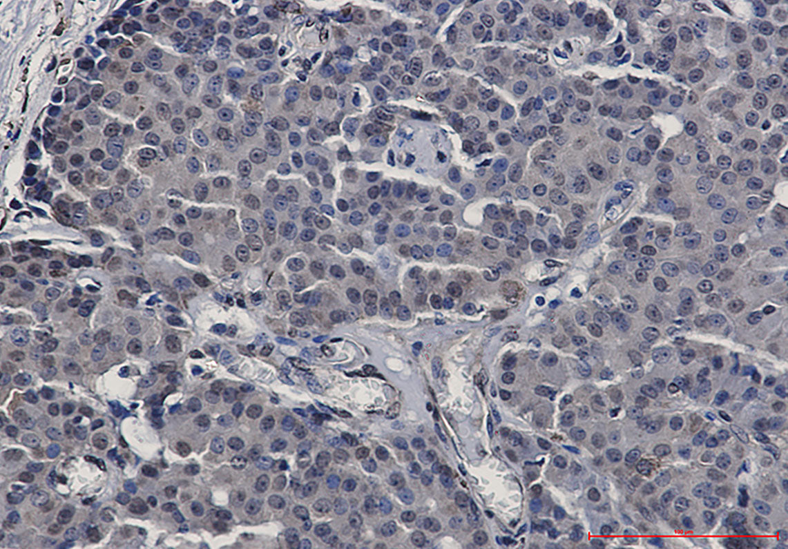 Anti-STAT5b Rabbit Monoclonal Antibody