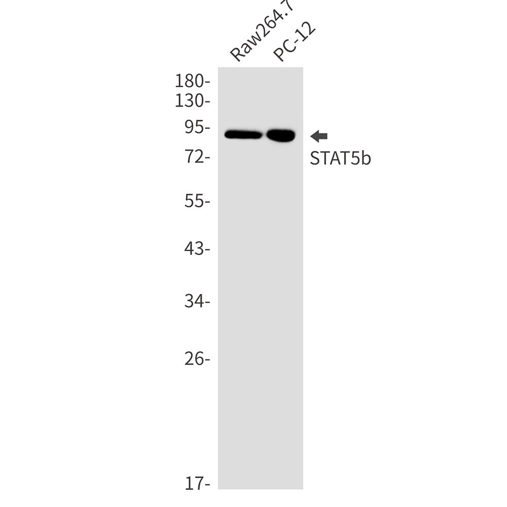 Anti-STAT5b Rabbit Monoclonal Antibody