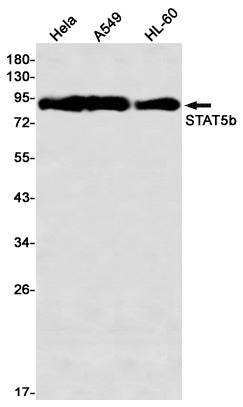 Anti-STAT5b Rabbit Monoclonal Antibody