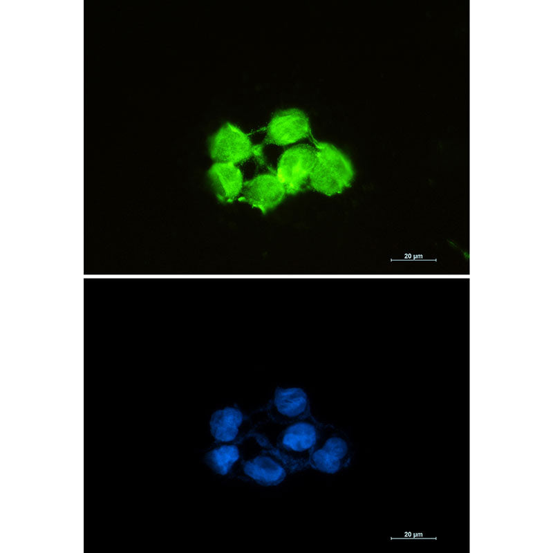 Anti-Superoxide Dismutase 1 Rabbit Monoclonal Antibody