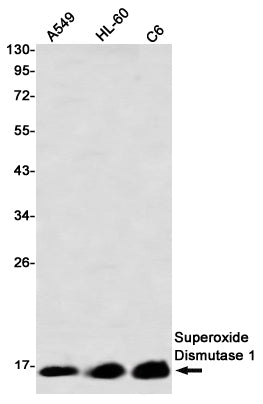 Anti-Superoxide Dismutase 1 Rabbit Monoclonal Antibody