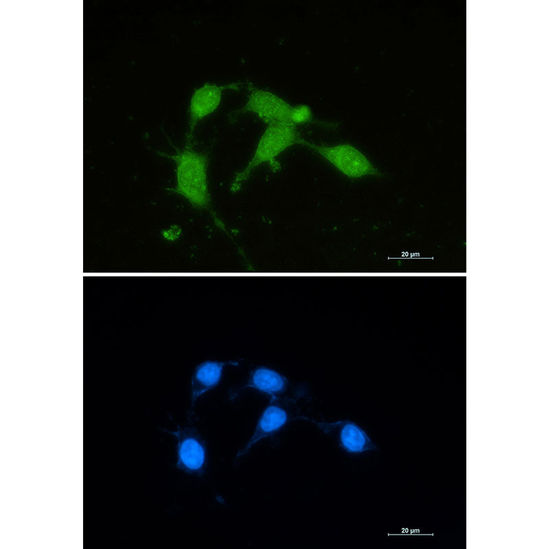 Anti-Superoxide Dismutase 1 Rabbit Monoclonal Antibody