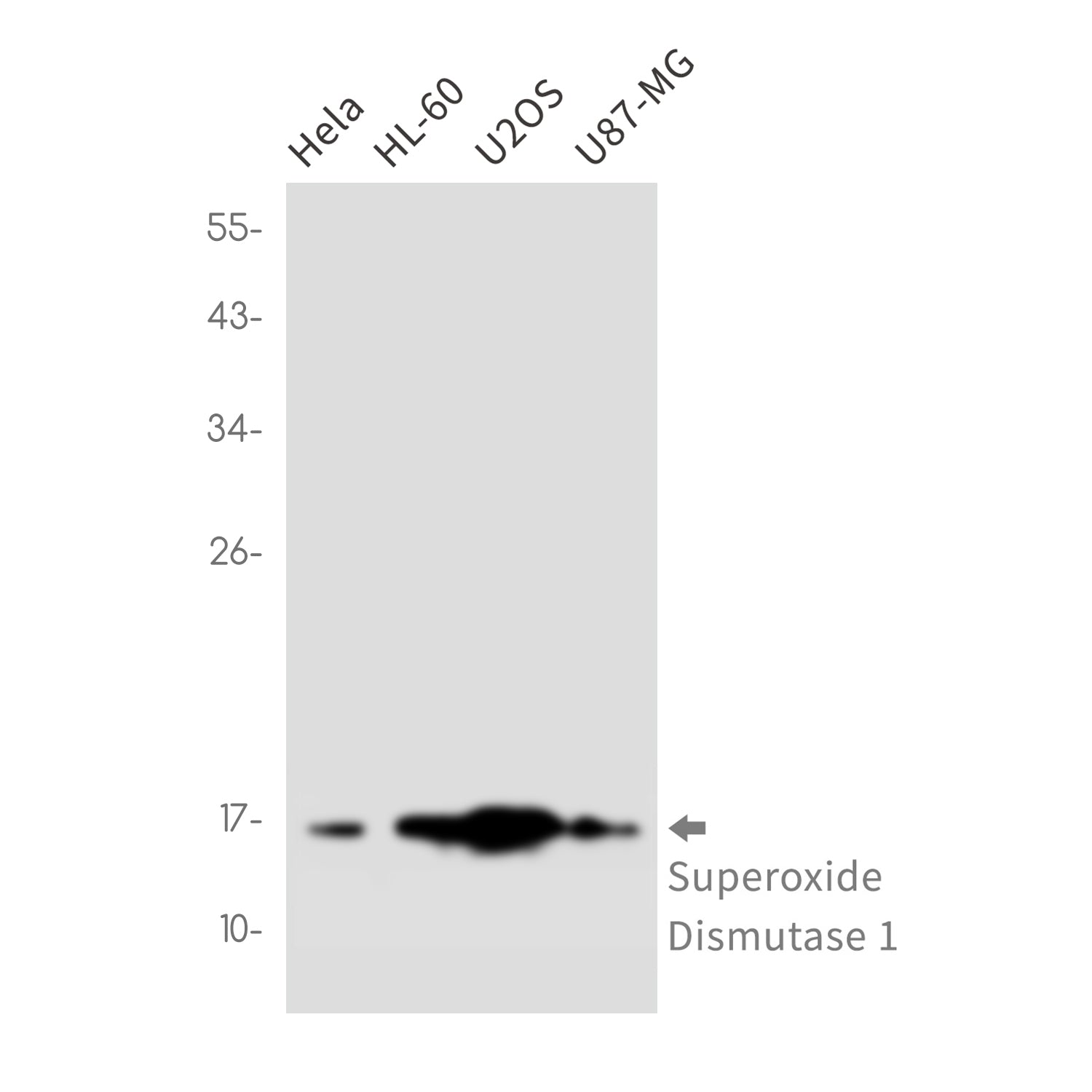 Anti-Superoxide Dismutase 1 Rabbit Monoclonal Antibody