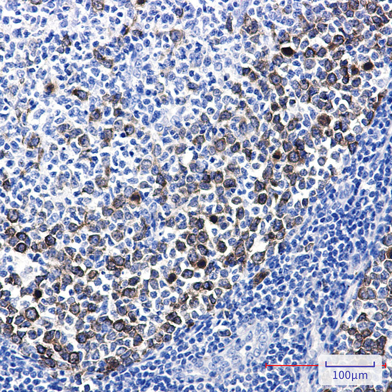 Anti-TACC3 Rabbit Monoclonal Antibody