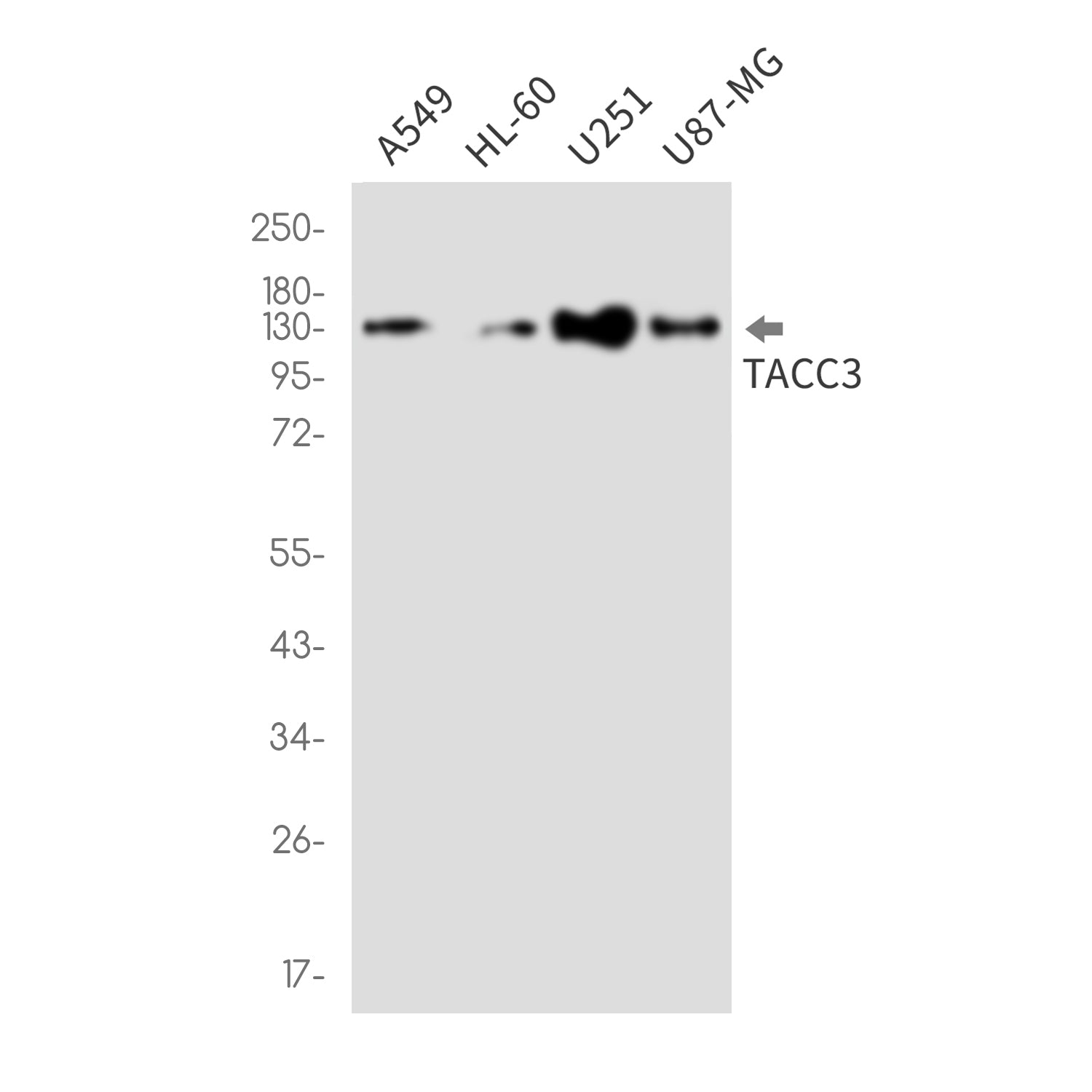 Anti-TACC3 Rabbit Monoclonal Antibody