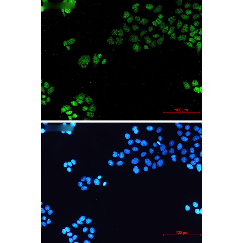 Anti-TATA Box Binding Protein Rabbit Monoclonal Antibody