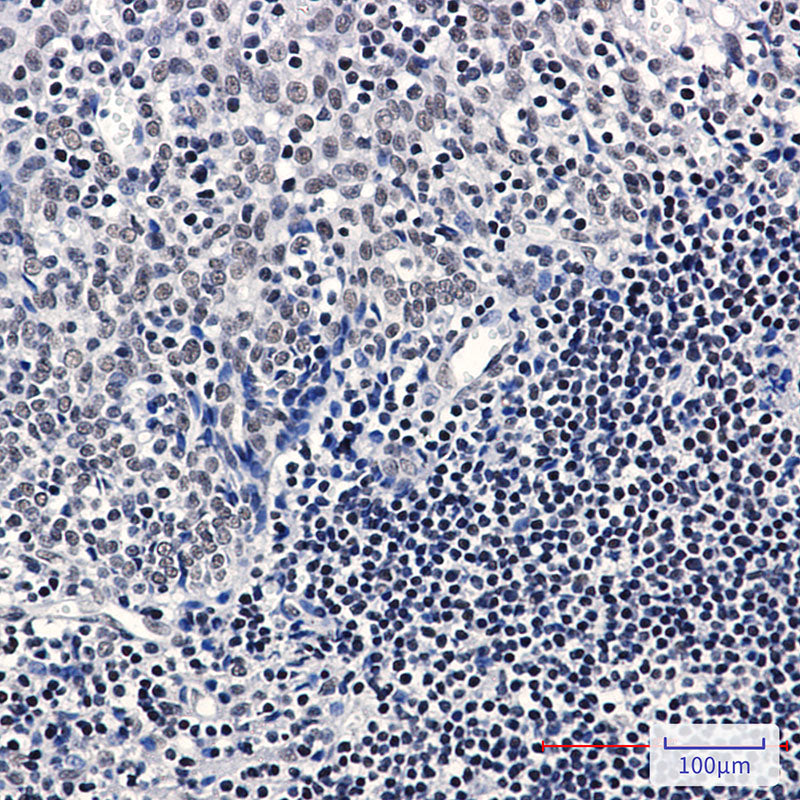 Anti-TATA Box Binding Protein Rabbit Monoclonal Antibody