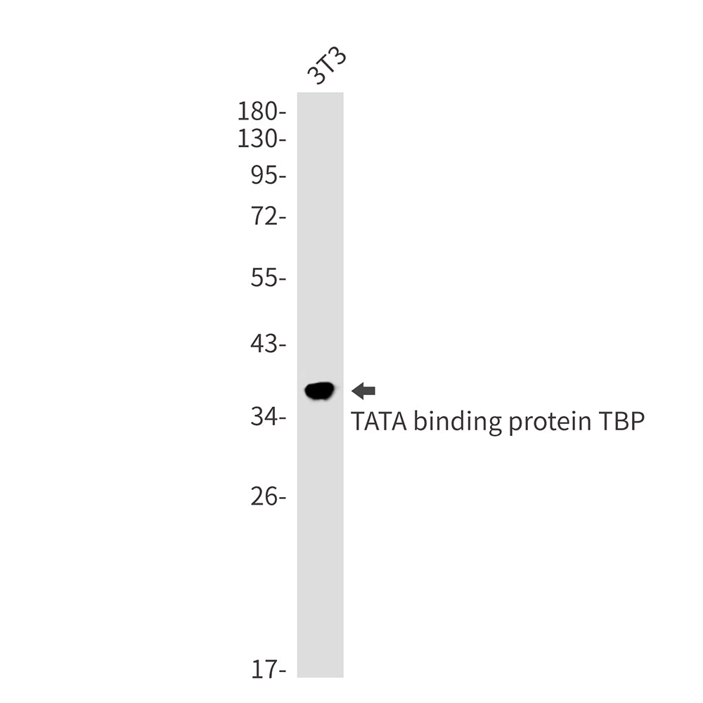 Anti-TATA Box Binding Protein Rabbit Monoclonal Antibody