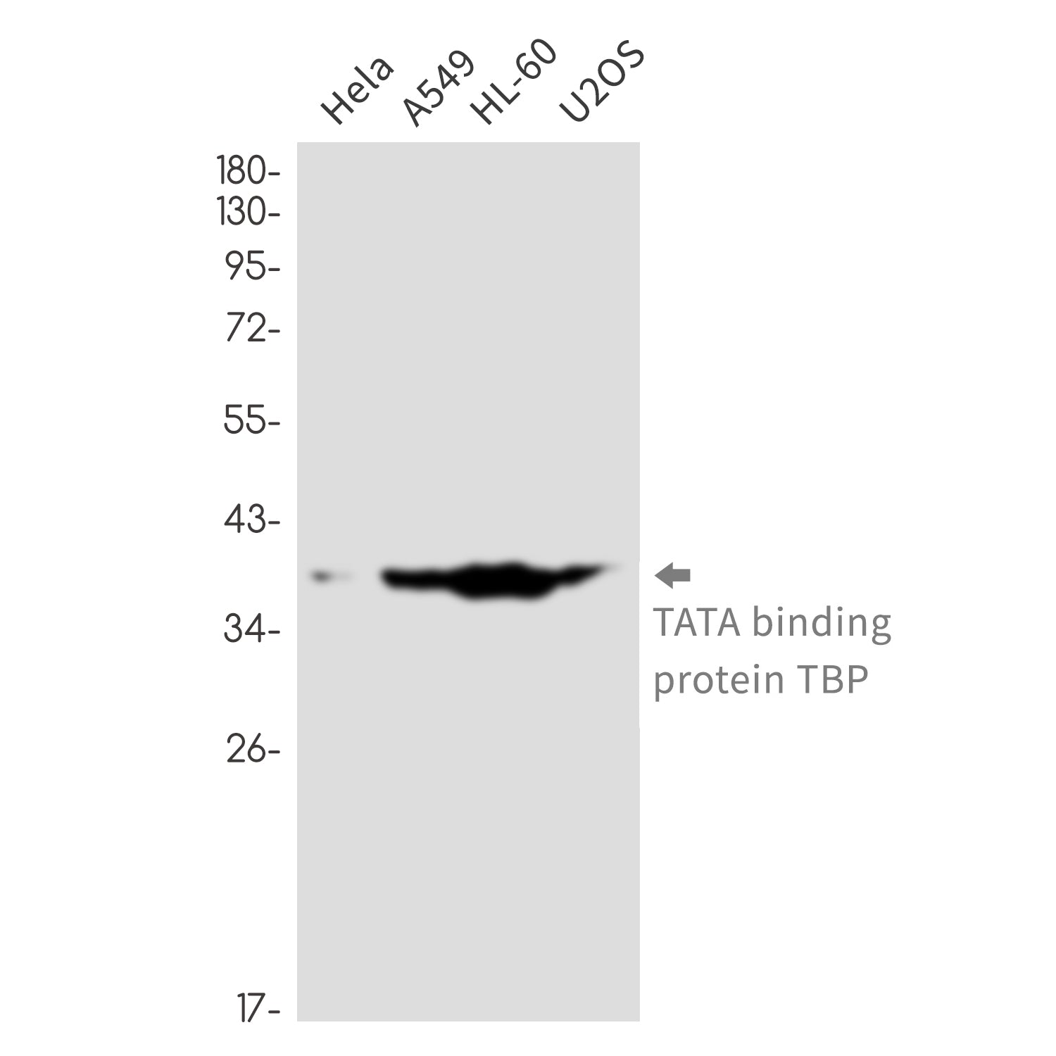 Anti-TATA Box Binding Protein Rabbit Monoclonal Antibody