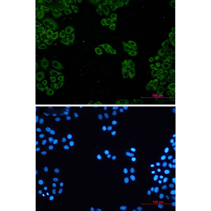 Anti-TCP 1 alpha Rabbit Monoclonal Antibody