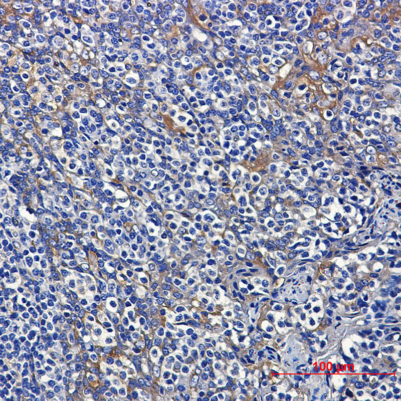 Anti-Dynein Light Chain Tctex Type 1 Rabbit Monoclonal Antibody