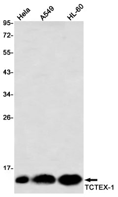 Anti-Dynein Light Chain Tctex Type 1 Rabbit Monoclonal Antibody